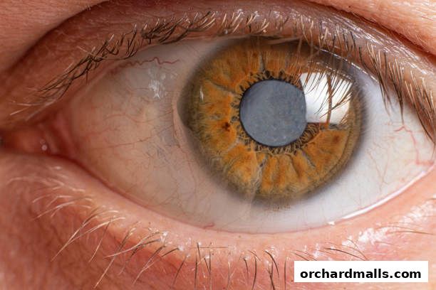 Aberdeen Eye Surgery