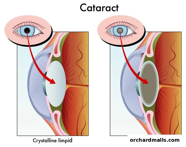 Aberdeen Eye Surgery