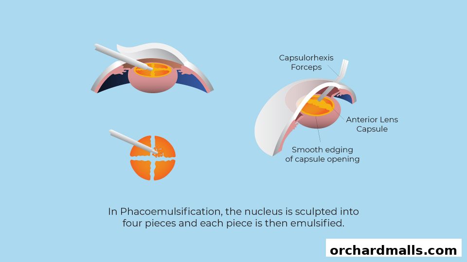 Aberdeen Eye Surgery