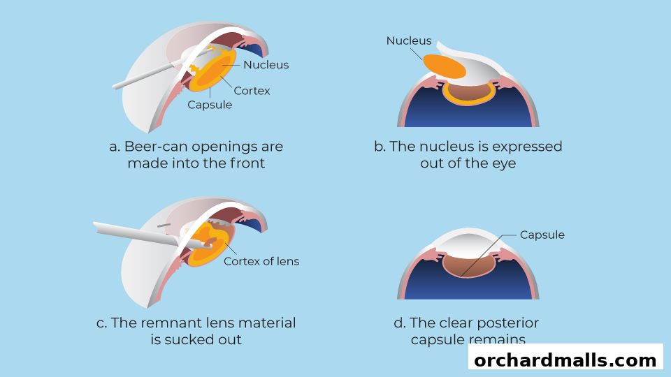 Aberdeen Eye Surgery