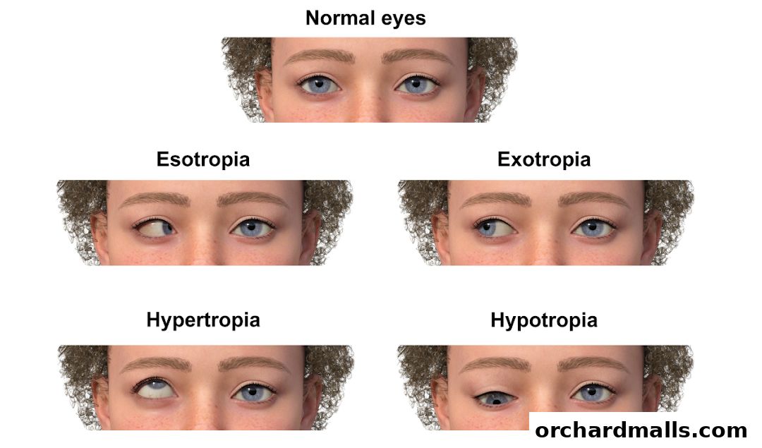 Aberdeen Eye Surgery