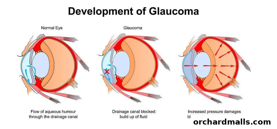 Aberdeen Eye Surgery