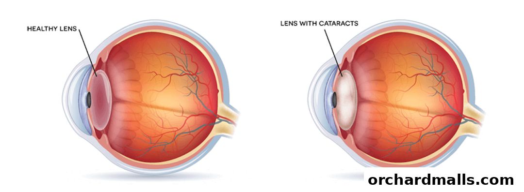 Aberdeen Eye Surgery