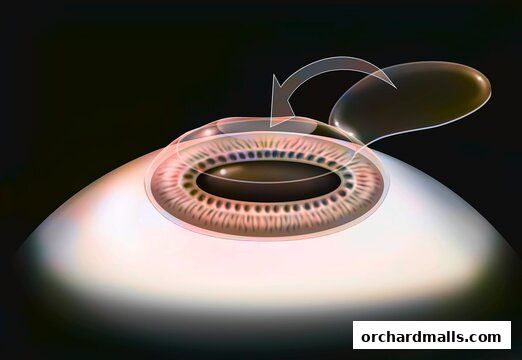 Aberdeen Eye Surgery