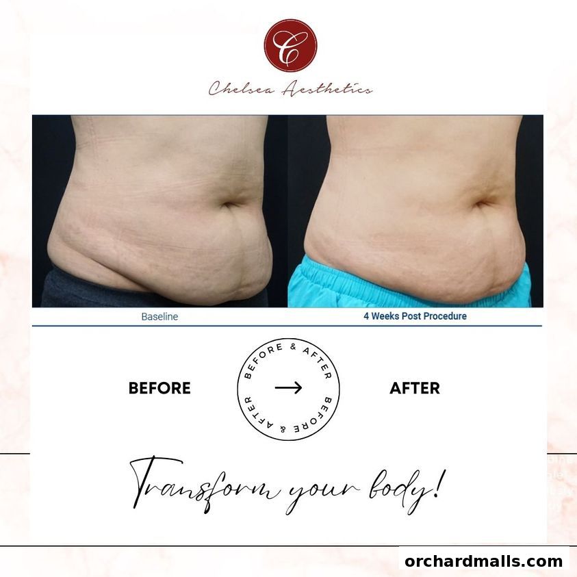 Before and after images showcasing body transformation results from Chelsea Aesthetics.