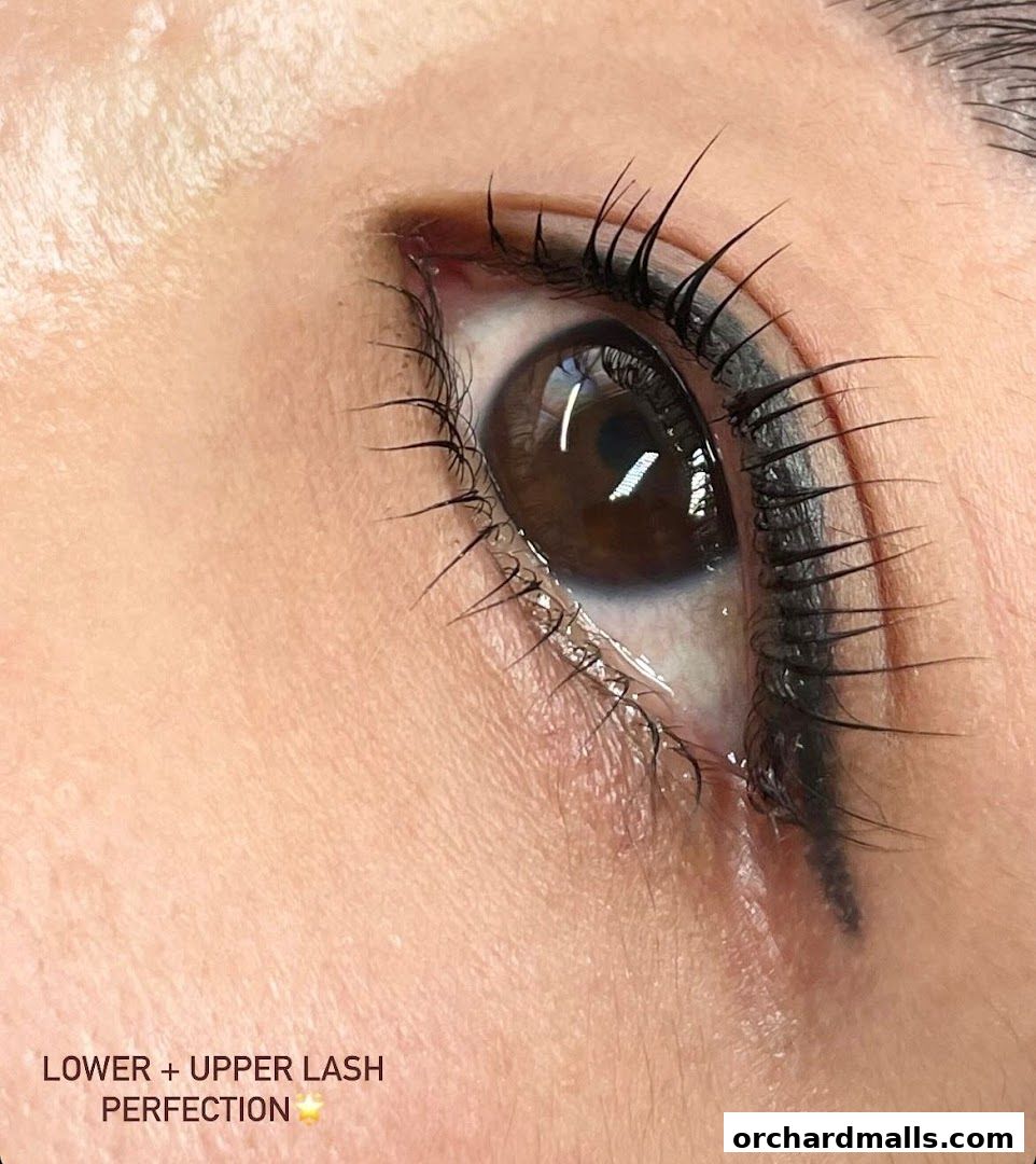 Dry Eye Clinic by The Eye Doctor