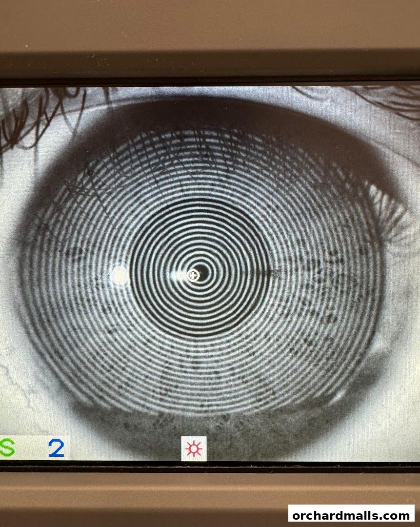 Hirocon Orchardgateway - Contact Lens Expert