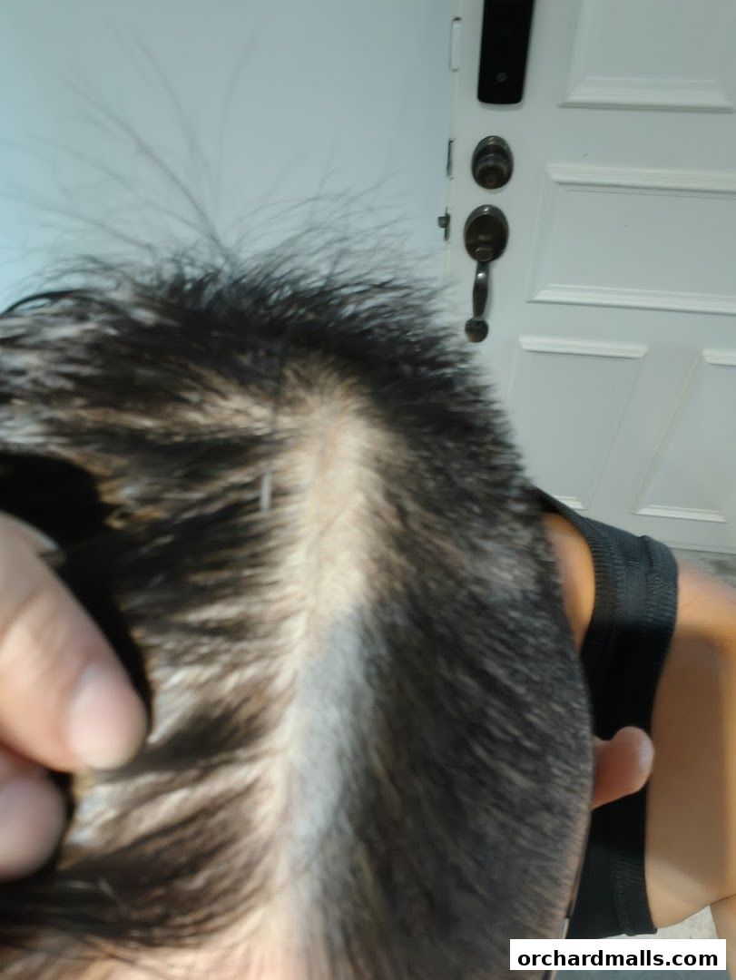Close-up of a person's hair and scalp, with a door in the background.