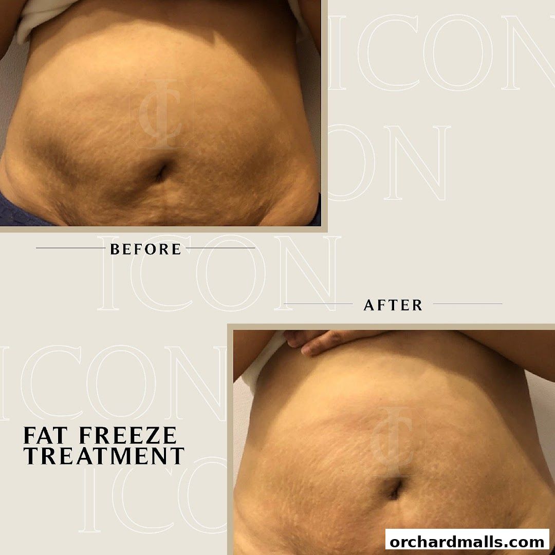 ICON Aesthetics - Orchard