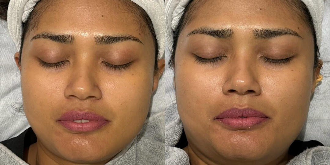 illumia Therapeutics Orchard - Medical Spa