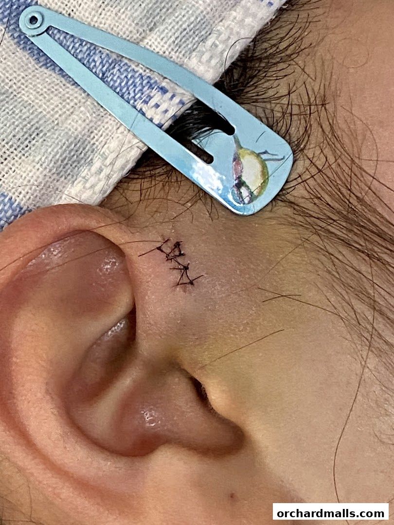 JJ Chua Rejuvenative Cosmetic  Laser Surgery