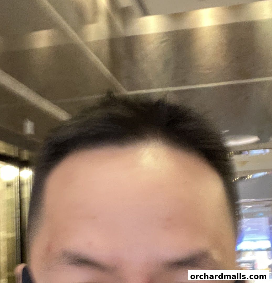 Close-up of a person's forehead and hair, with a blurred background.