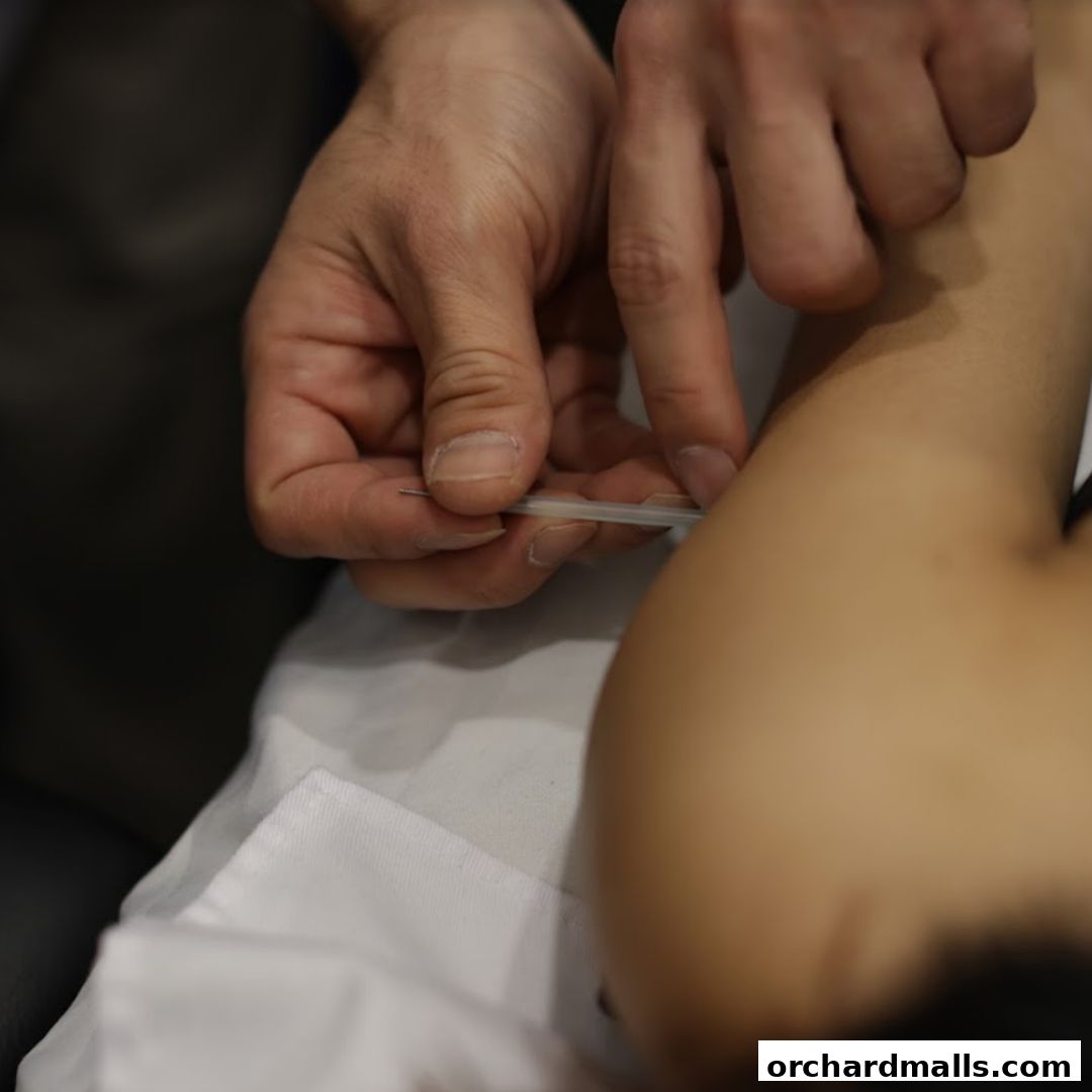 A close-up of an acupuncturist performing acupuncture on a patient's arm.