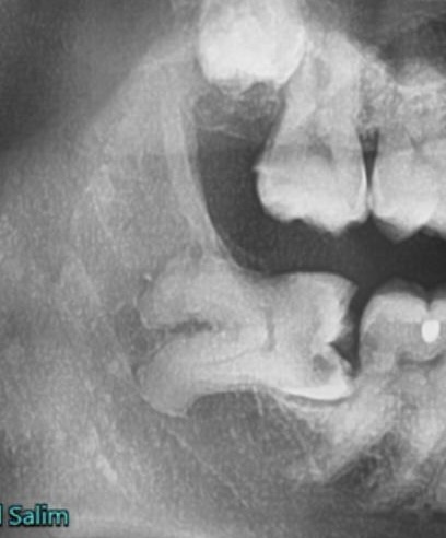 Nuffield Dental Jewel Wheelock