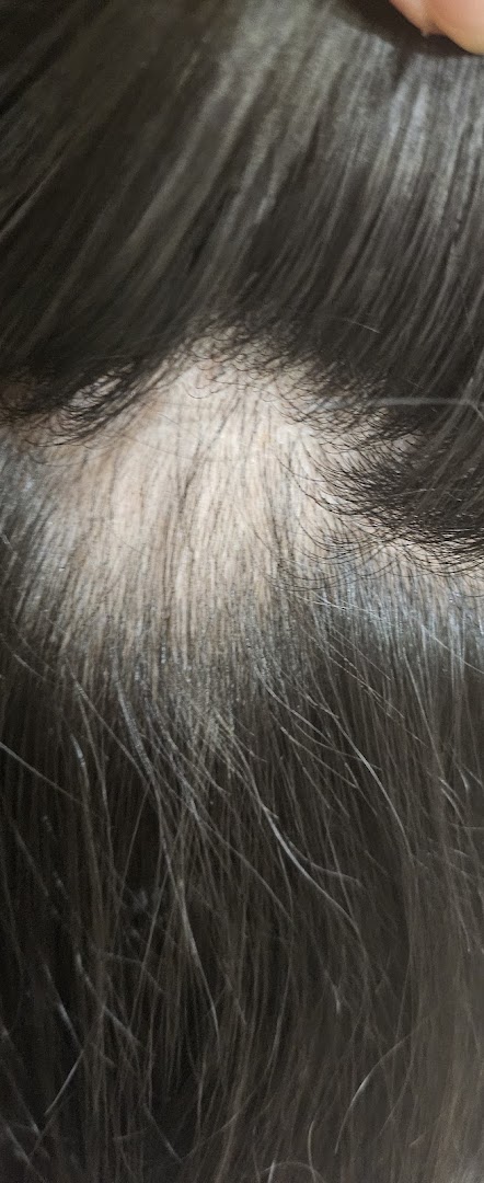 Organic Hair Regrowth Solutions