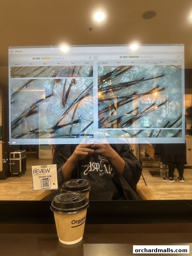 Microscopic view of hair follicles and scalp analysis on a screen, with coffee cups in the foreground.