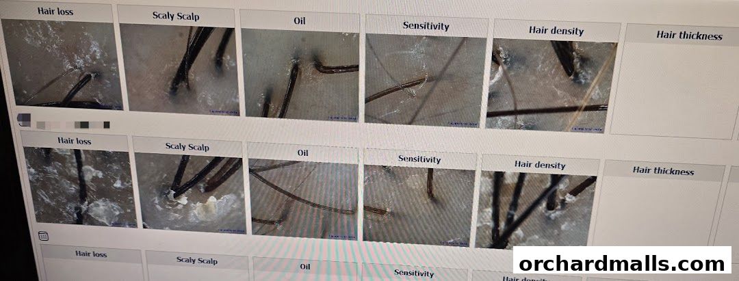 Microscopic views of scalp conditions including hair loss, oiliness, and thickness.