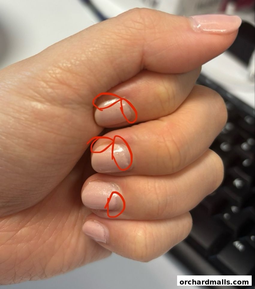 Close-up of a hand with light pink gel nails, some with red markings.