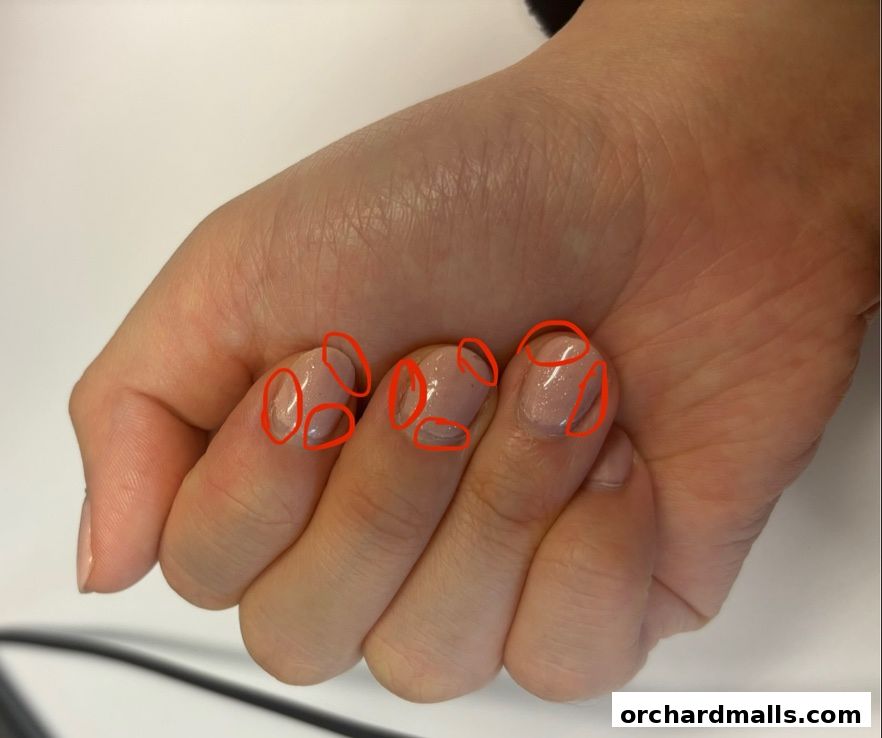 Close-up of a hand with manicured nails, some with red circles highlighting details.