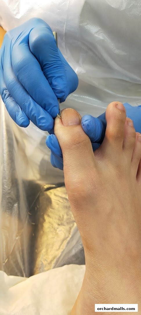 A close-up of a foot receiving professional nail care with blue-gloved hands.