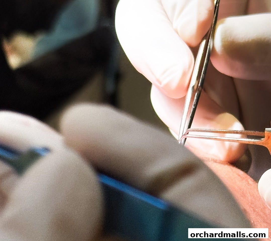 Sage Medical Clinic  Hair Transplant Singapore