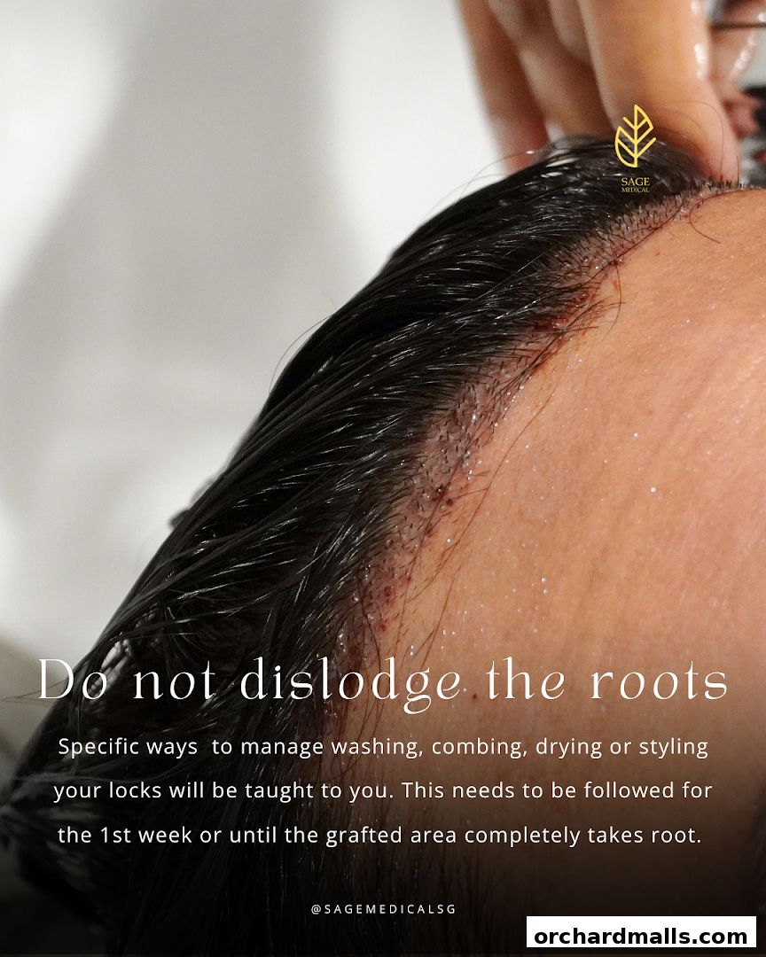 Sage Medical Clinic  Hair Transplant Singapore