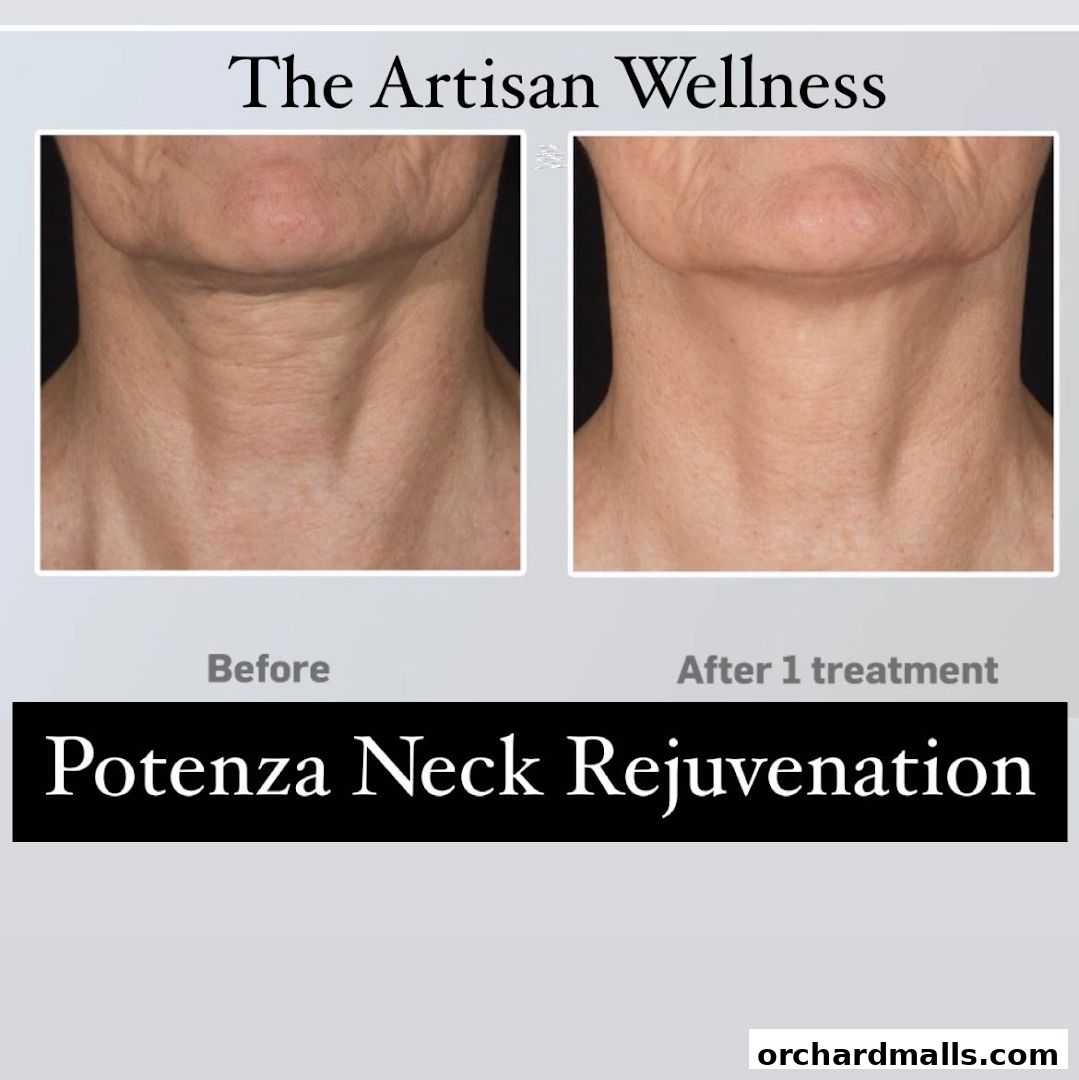 The Artisan Wellness - Body Contouring  Fat Loss  HIFU  Diastasis Recti Singapore