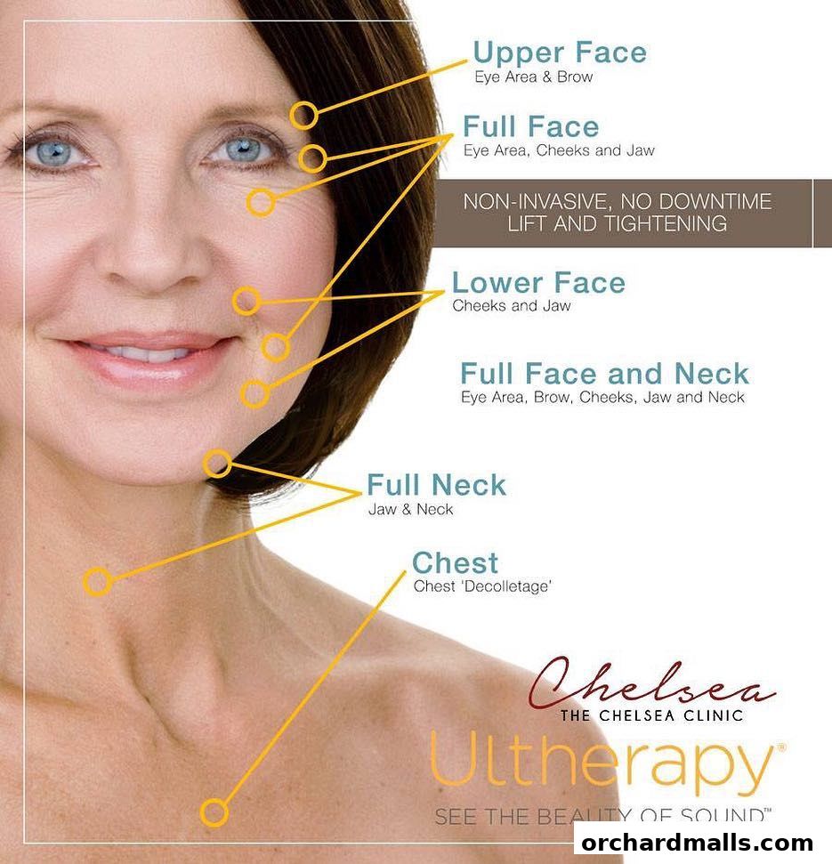 A woman's face and neck with treatment areas highlighted for Ultherapy.
