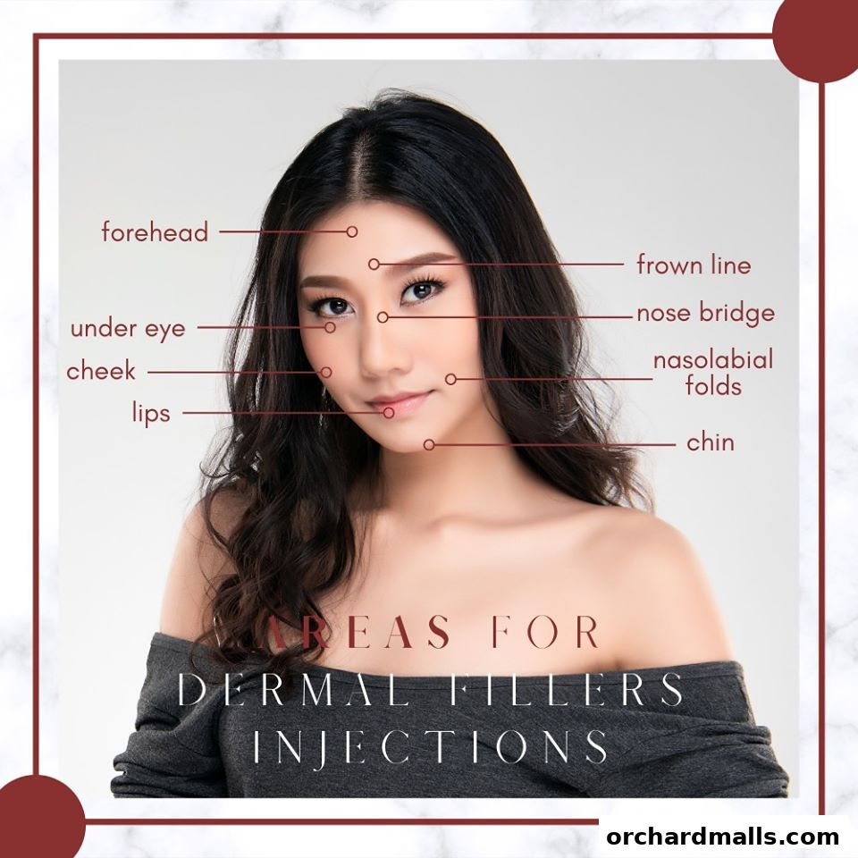 Diagram showing areas for dermal filler injections on a woman's face.