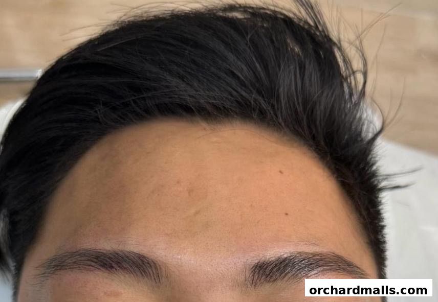 The DRx Medispa SMP 313 Somerset