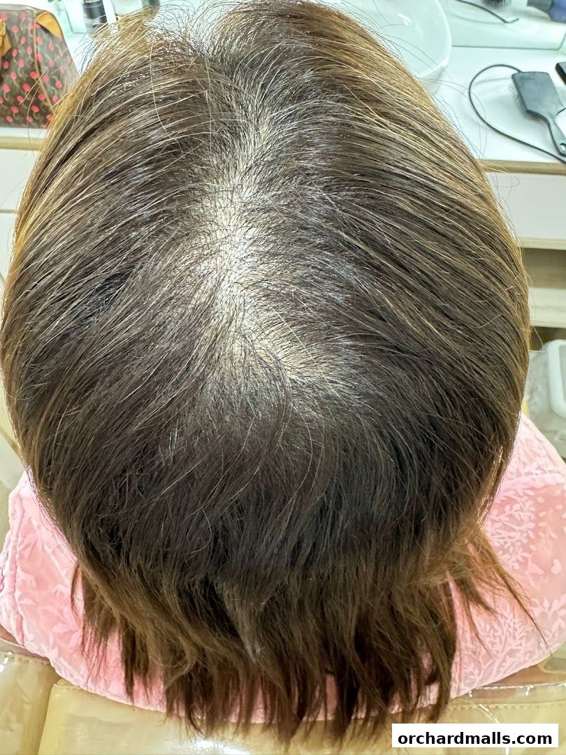 The DRx Medispa SMP 313 Somerset