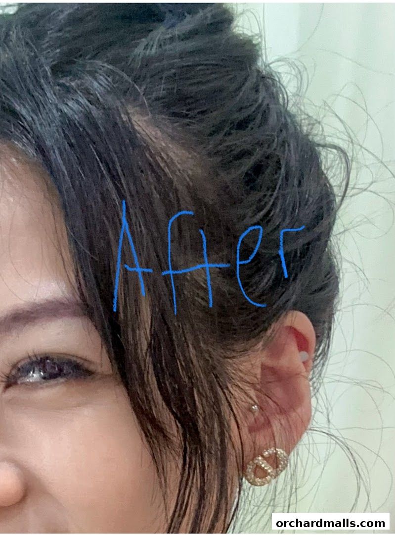 The DRx Medispa SMP 313 Somerset