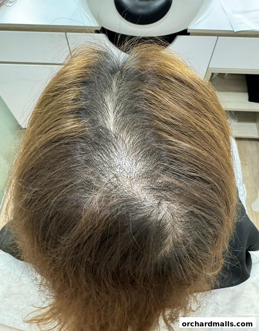 The DRx Medispa SMP 313 Somerset