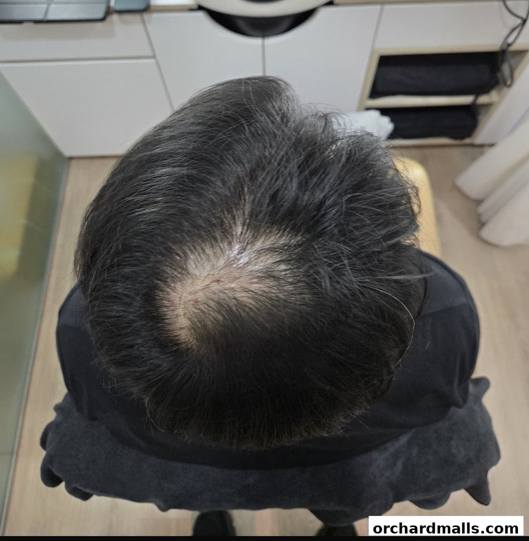 The DRx Medispa SMP 313 Somerset