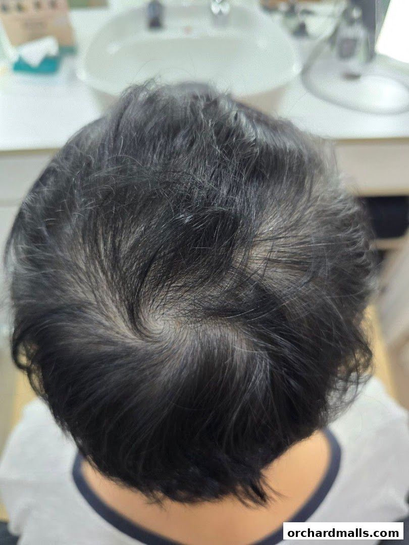 The DRx Medispa SMP 313 Somerset