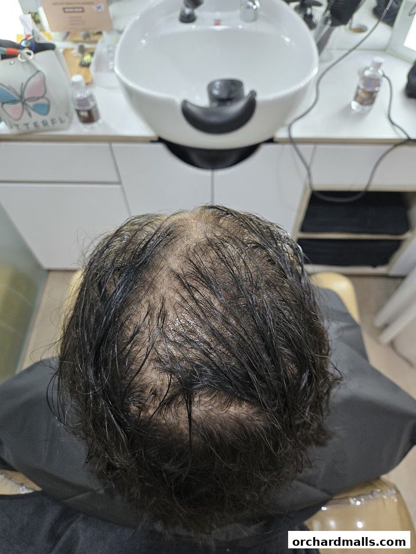 The DRx Medispa SMP 313 Somerset