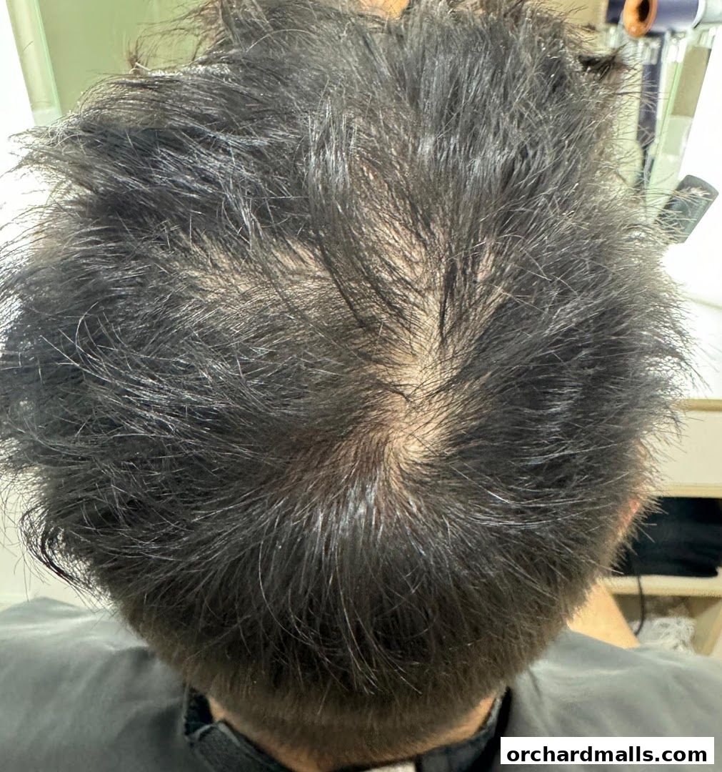 The DRx Medispa SMP 313 Somerset