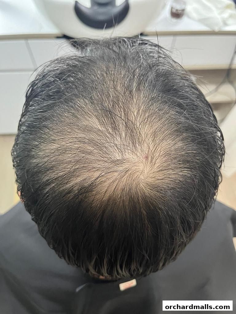 The DRx Medispa SMP 313 Somerset