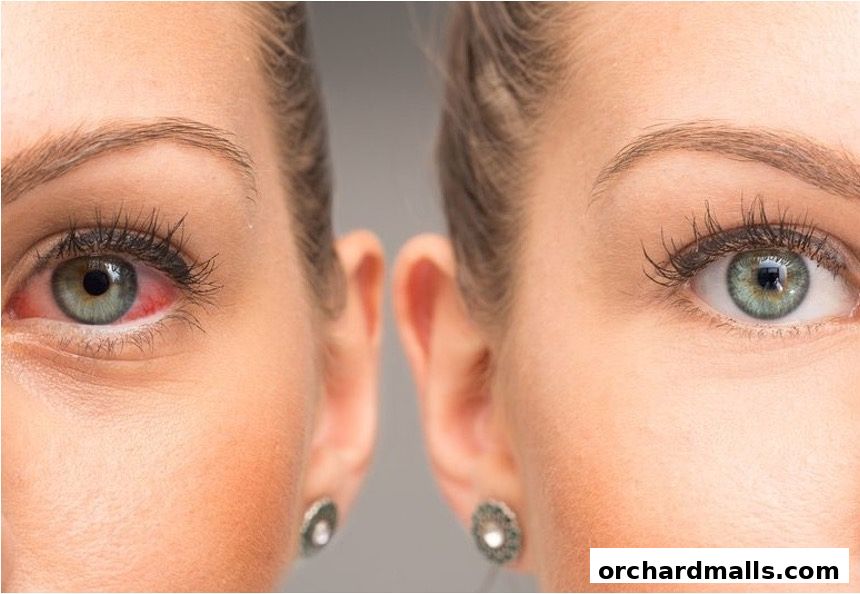 The EyeClinic by Dr Cheryl Lee