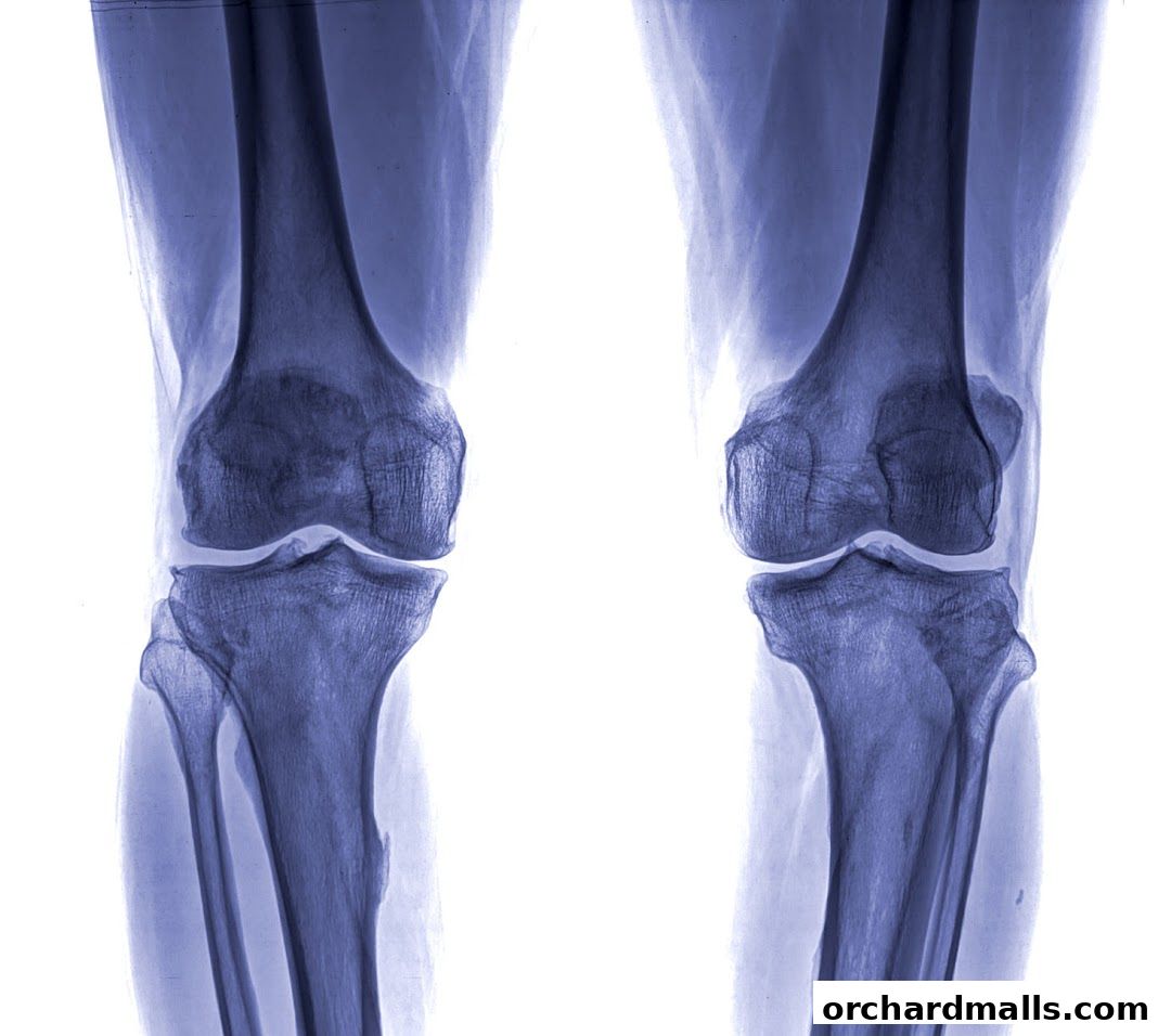 The Pain Relief Clinic 50 Consultation. Insurance  Medisave Claimable