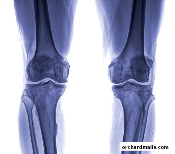 The Pain Relief Clinic 50 Consultation. Insurance  Medisave Claimable