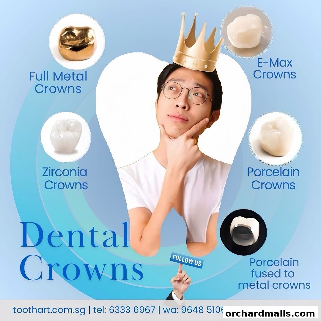 A graphic showcasing different types of dental crowns with a man wearing a crown.