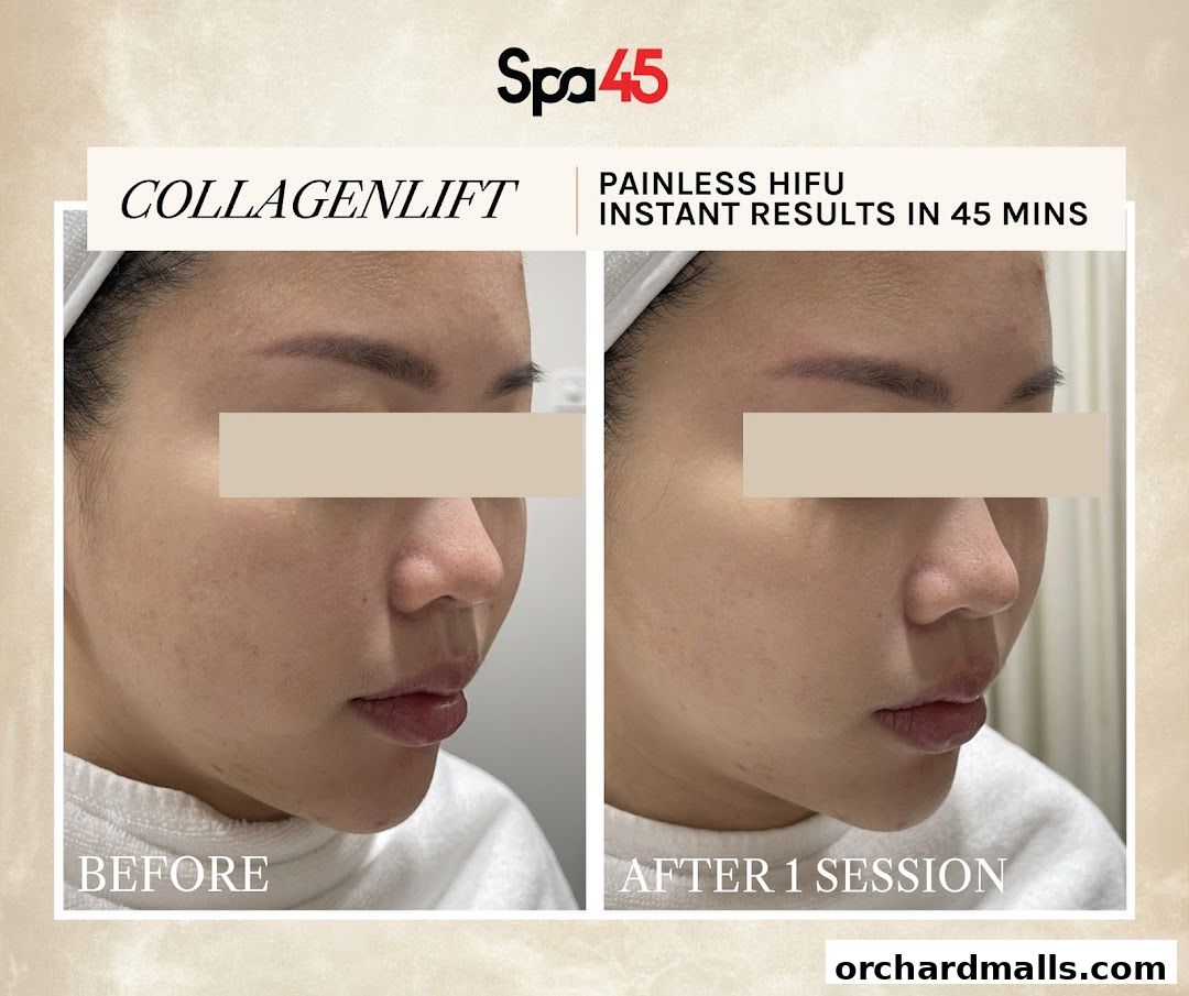 Vim Beauty - Facials  HIFU  Exosomes  Bojin  Guasha